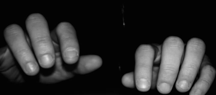 A black-and-white photograph of someone’s hands (mine).